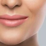 Get natural-looking results with Juvederm Filler. Enhance your appearance with this professional-grade treatment.